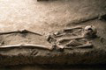 Mimoriadny nález: V zuboch z doby bronzovej objavili... To snáď nie!