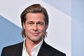 Jaro Slávik trpí rovnakou poruchou ako Brad Pitt: V spoločnosti mu spôsobuje trápenie!