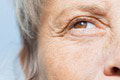 Váš zrak môže predpovedať demenciu až 12 rokov dopredu! Deje sa vám TOTO? Spozornite