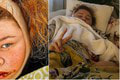 Evelyn po vážnej operácii tváre: Po mesiacoch bolestí je trápenie konečne preč!