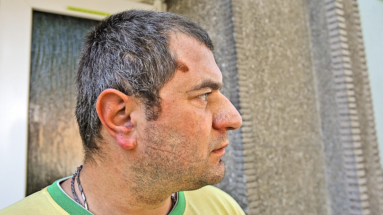 Viktor sa pri šarvátke zranil aj na hlave.