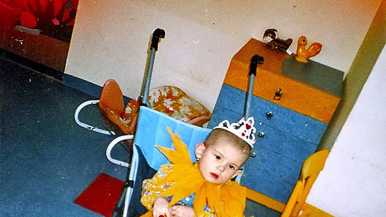 Dievčatko tesne po operácii, keď malo 2,5 roka.