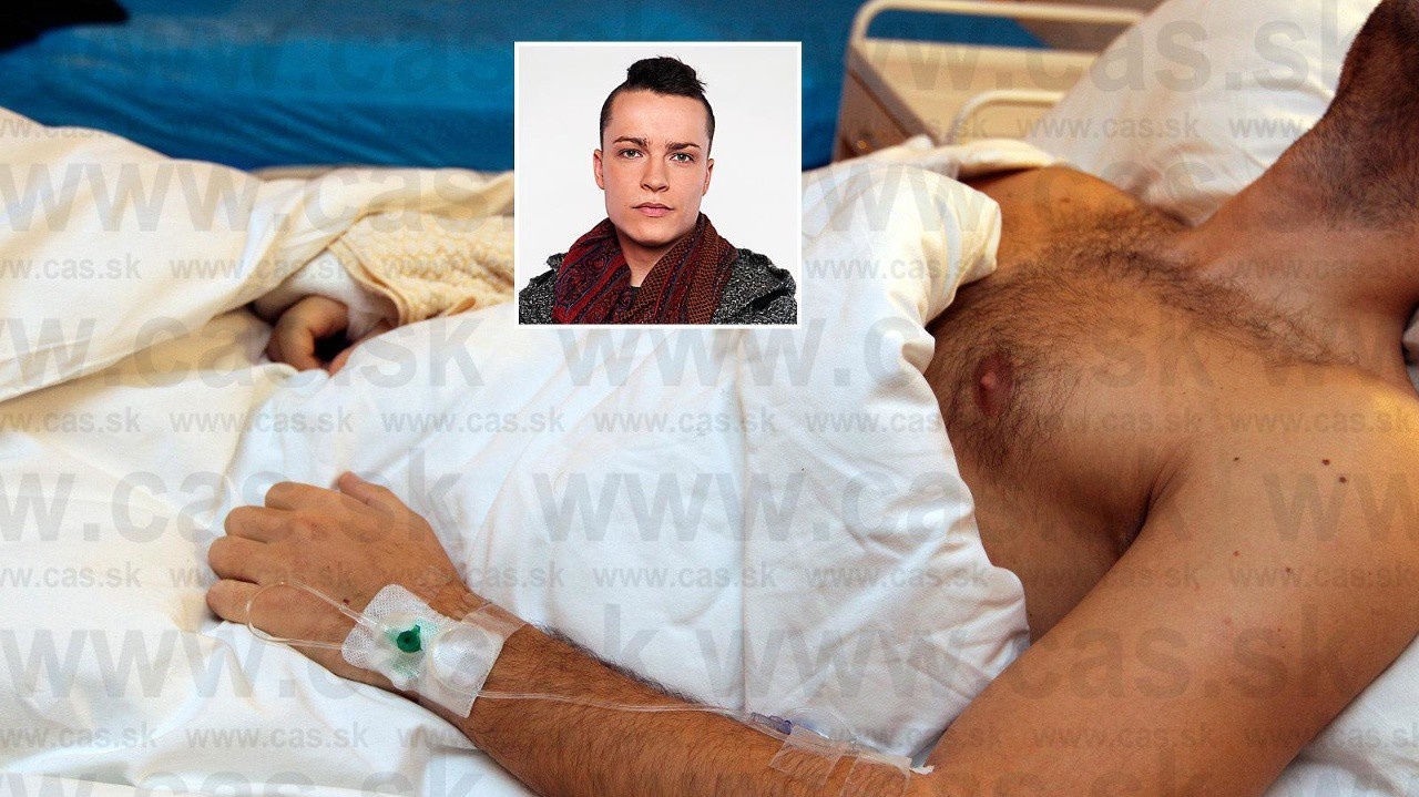 Exfarmár Adam Kováč má malér: Zrazil človeka na priechode!