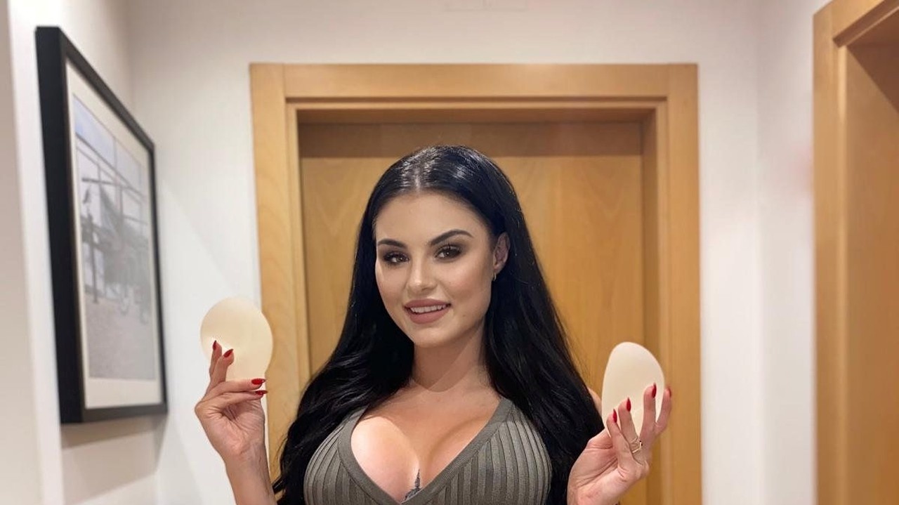 Modelka sa zbavila implantátov.
