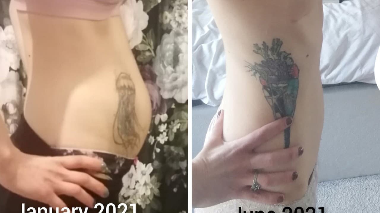 Tamara si nechala zväčšiť prsia veľkosti A na dvojité D.