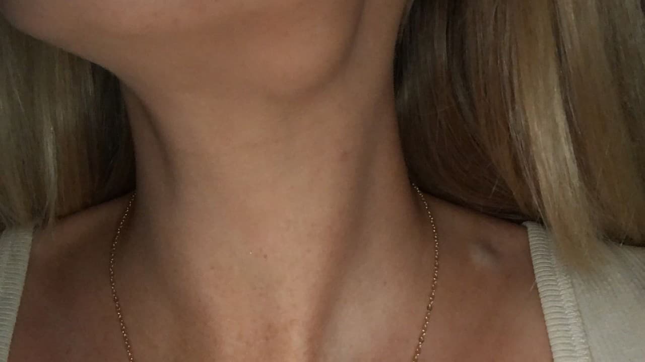 26-ročnej Helen zachránil život virálny trend na TikToku.