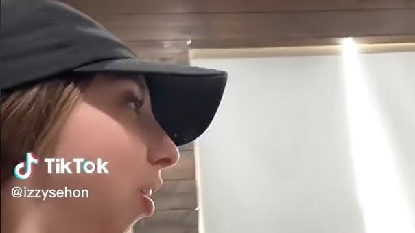Jej zriedkavý stav spôsoboval, že vyzerala, akoby jej chýbala čeľusť. 