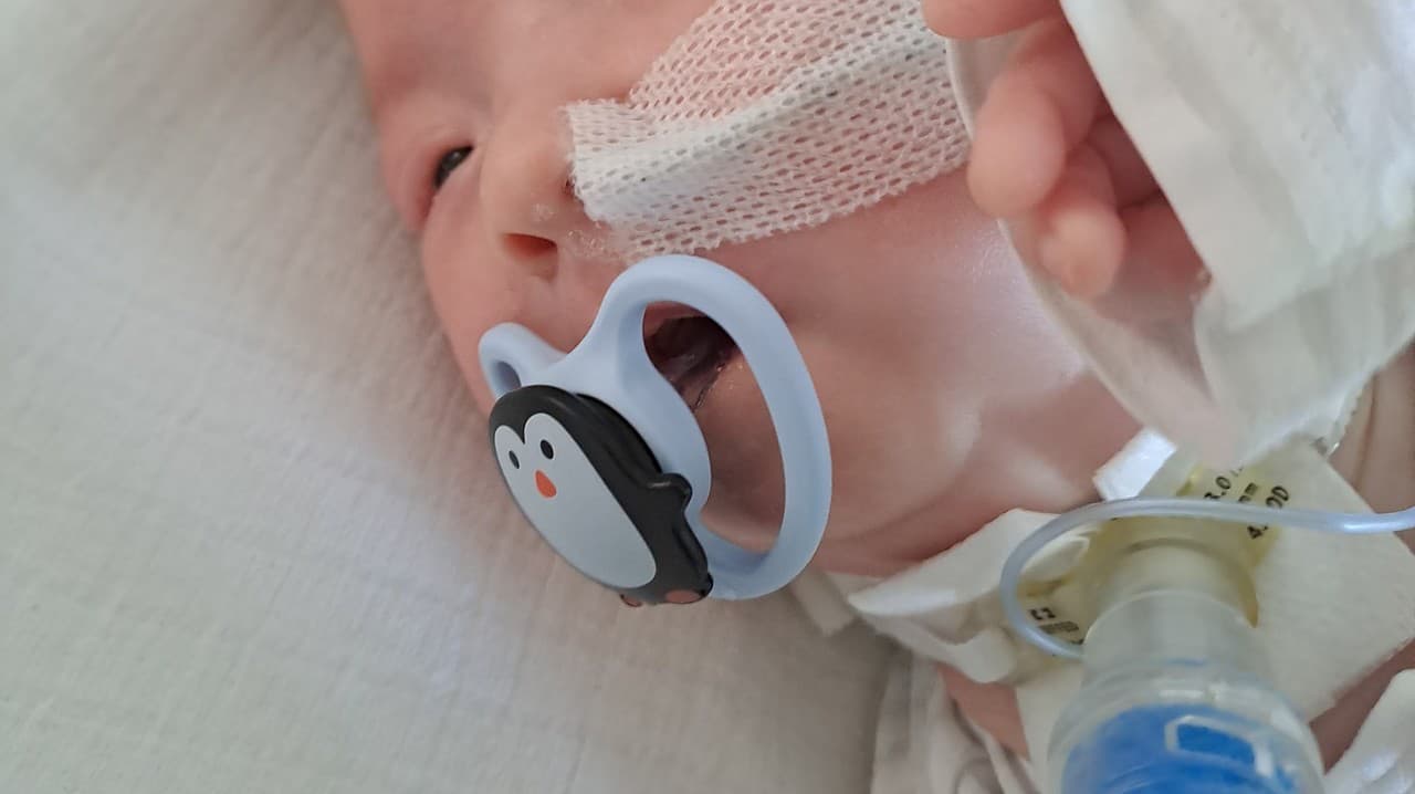 Marek (3 mois) a une ouverture étroite dans la gorge, il ne peut pas respirer tout seul : une opération à 30 000 peut le sauver