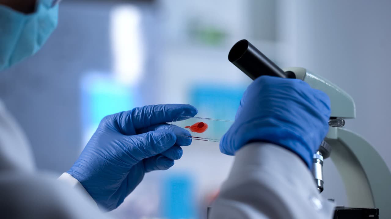 VAROVANIE: Uniknú z laboratória vzorky nebezpečného vírusu a iných patogénov?!
