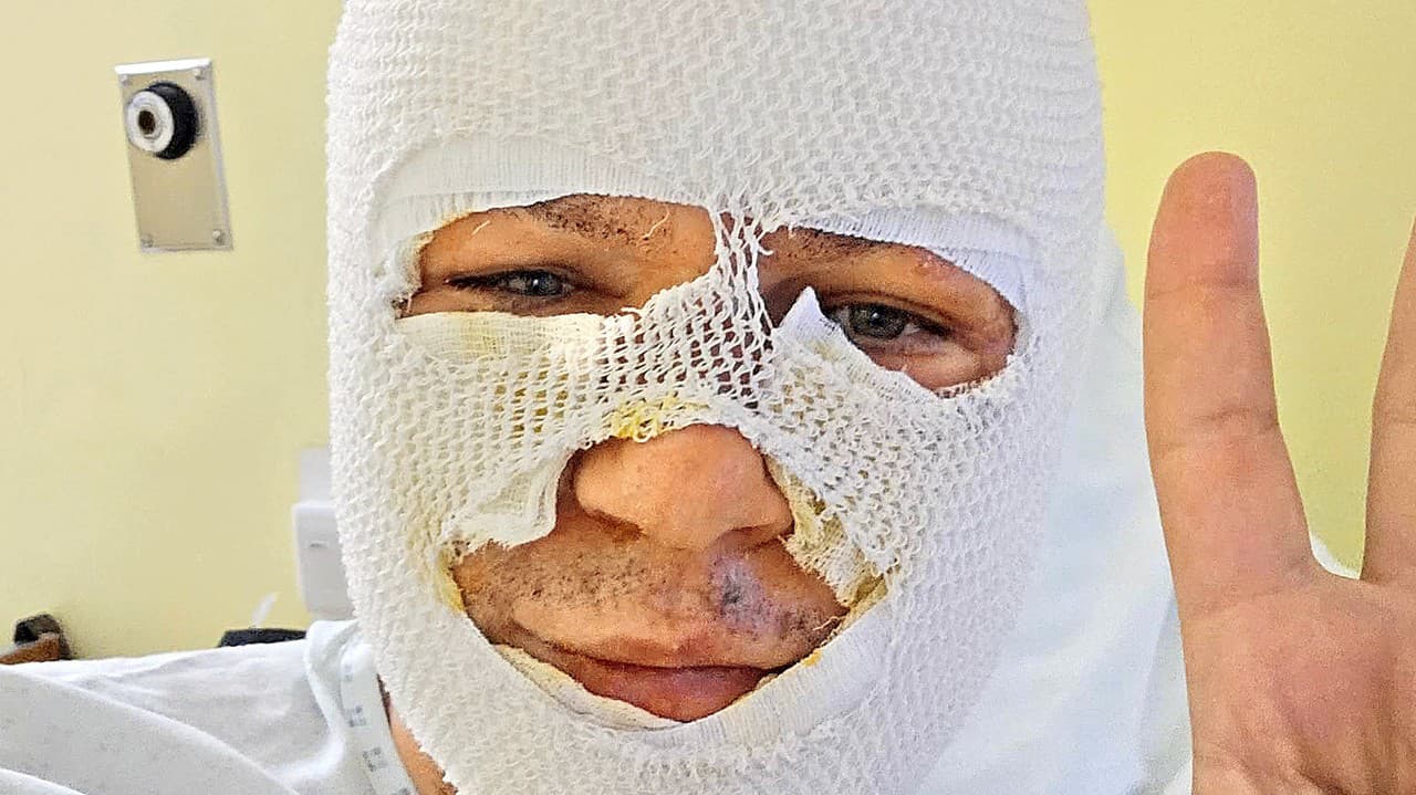 Exposlanec Žiak PRVÝKRÁT po hrozivom incidente ukázal tvár: Ostane bez trvalých následkov?