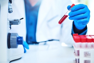 Closeup shot of a scientist analyzing samples in a laboratory