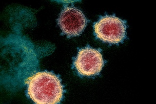 Nový koronavírus SARS-CoV-2, ktorý spôsobuje respiračné ochorenie COVID-19.