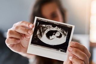 Shot of a woman holding a sonogram of her unborn baby