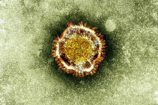 Na snímke nový typ koronavírusu, ktorý pochádza z rovnakej skupiny ako vírus SARS.