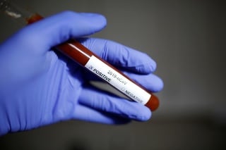 Francúzsko hlási 5. človeka pozitívne testovaného na koronavírus (ilustračné foto).