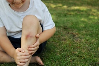 Young boy holds a sore leg that received a injury while playing outdoors.