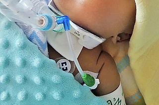 Drobučký Mirio zomrel v nemocnici ako 10-mesačné bábätko. 