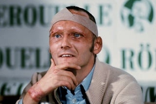 Niki Lauda mal po nehode popáleniny najmú na hlave.