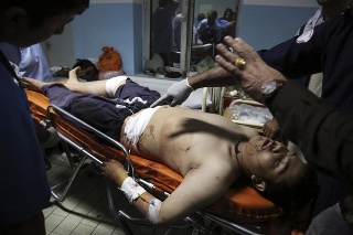 Zranený muž po výbuchu v Kábule.