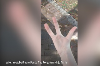 Podelila sa so svojou raritou na internete: Žena má na ruke iba 3 prsty!
