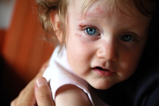 scared child with a wound in a parent's hands