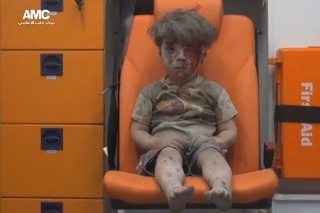 Päťročný Umrán Dakníš sa zranil pri nálete v Aleppe.