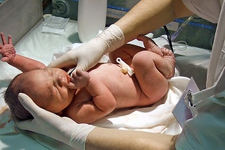Pri narodení meral Tadeáš až 62 cm.