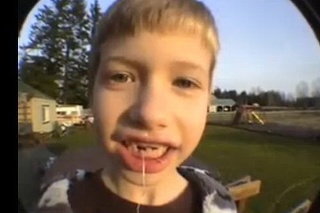 Chlapcovi vytrhla zub raketa.