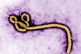 Guinea zápasí s epidémiami štyroch vírusových ochorení: osýpok, žltej zimnice, COVID-19 a najnovšie aj s ebolou (na snímke vírus eboly)