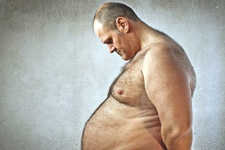 Obezita je jednou z príčin vzniku aterisklerózy