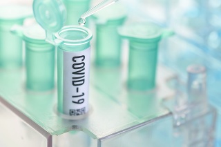 Corona virus: vial with pipette in laboratory