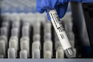 Prvých 100-tisíc antigénových testov už má svojho adresáta (ilustračné foto).