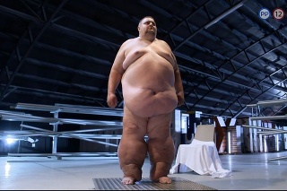 Apríl 2019 - 255kg: Juraj bol extrémne obézny.