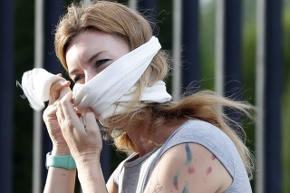 Žena v uliciach Česka si chráni horné a dolné dýchacie cesty pred nákazou koronavírusom. 