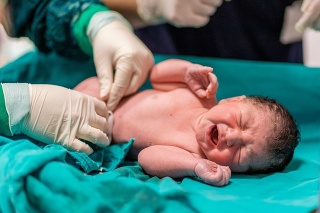 doctor cutting baby's umbilical cord