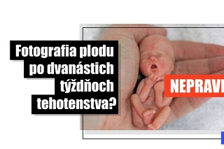  Na slovenskom Facebooku sa objavila staršia údajná fotografia plodu po troch mesiacoch tehotenstva, v skutočnosti je to niečo úplne iné.
