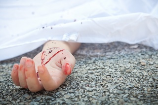 Bloody hand at an accident scene pavement.