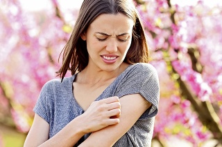 Na štipnutia či bodnutia si dajte pozor hlavne ak ste alergickí.