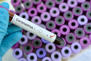 Blood sample with respiratory coronavirus positive