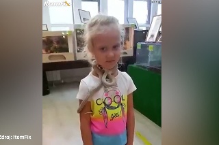 Tak to snáď nie! Had v ruskej zoo uhryzol 5-ročné dievčatko priamo do tváre