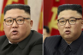Severokórejský vodca Kim Čong-un schudol približne 20 kilogramov.