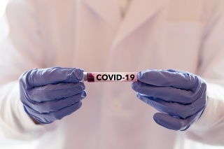 COVID-19 named by WHO for Novel coronavirus NCP concept. Doctor or lab technician holding blood sample with novel (new) coronavirus N.C.P. in Wuhan, Hubei Province, China, medical and healthcare