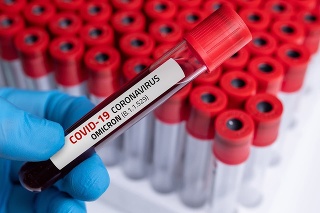 Nový variant koronavírusu sa z Juhoafrickej republiky šíri po celom svete.