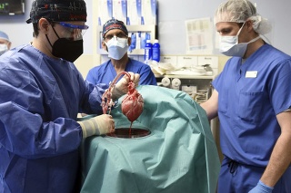 Lekári v USA transplantovali pacientovi srdce geneticky modifikovaného ošípaneho.