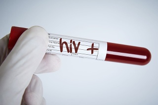 Laboratory Request, Hiv Test, Hiv Positive