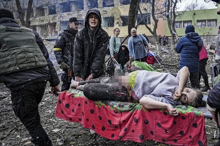 Bombardovali pôrodnicu: Rusi sa na Ukrajine neštítia ostreľovať aj pôrodnice. Lekári , ktorí utiekli, sa však snažia pomáhať aspoň na Slovensku. 

