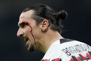 Zlatan Ibrahimovič z AC Miláno reaguje počas zranenia po hlavičkovom súboji. 