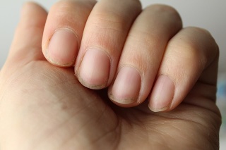 damaged damaged nail without manicure with dirt close-up. Nail Health Care.