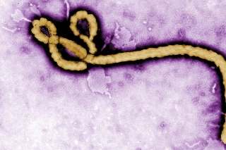 Guinea zápasí s epidémiami štyroch vírusových ochorení: osýpok, žltej zimnice, COVID-19 a najnovšie aj s ebolou (na snímke vírus eboly)