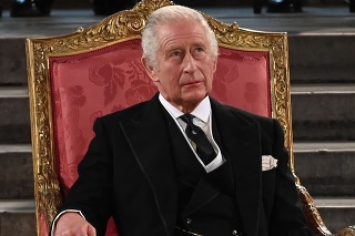 Bystré oči fanúšikov kráľovskej rodiny si všimli, že kráľa Karola III. trápi silný opuch prstov. 